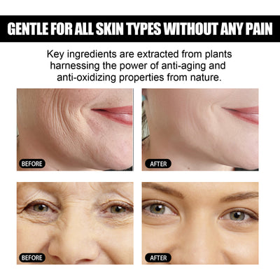 EELHOE Face Instant Firming & Lifting  Wrinkle Reducing & Brightening Lift & Firm Facial Skin - 5 - cjdropshipping
