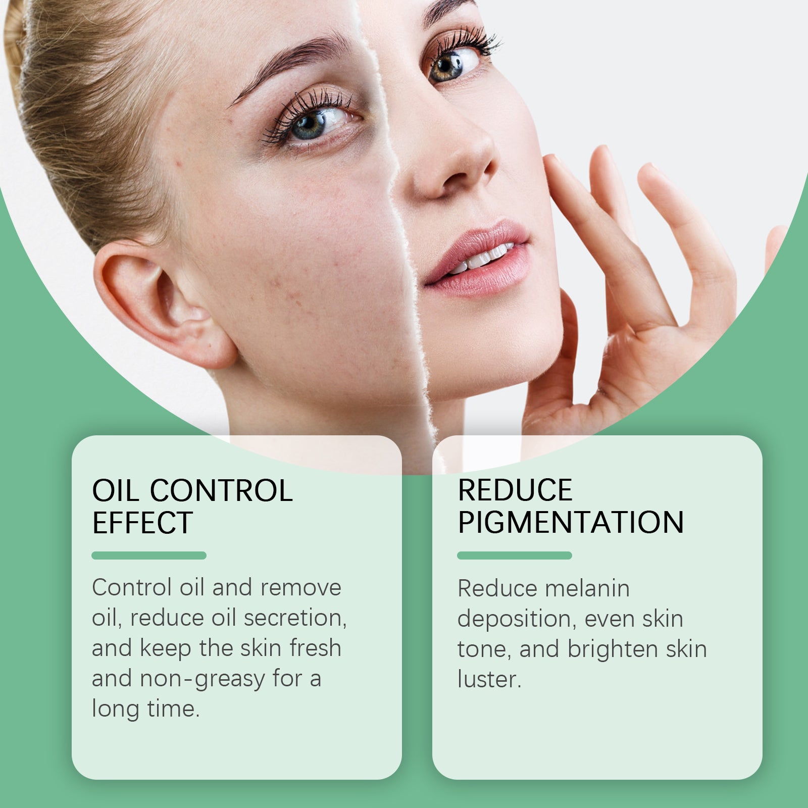 West&Month Azelaic Acid Essence Cream, Repair Moisturizing Moisturizing Face Oil Control Moisturizing Mild Refreshing Cream - 5 - CJ