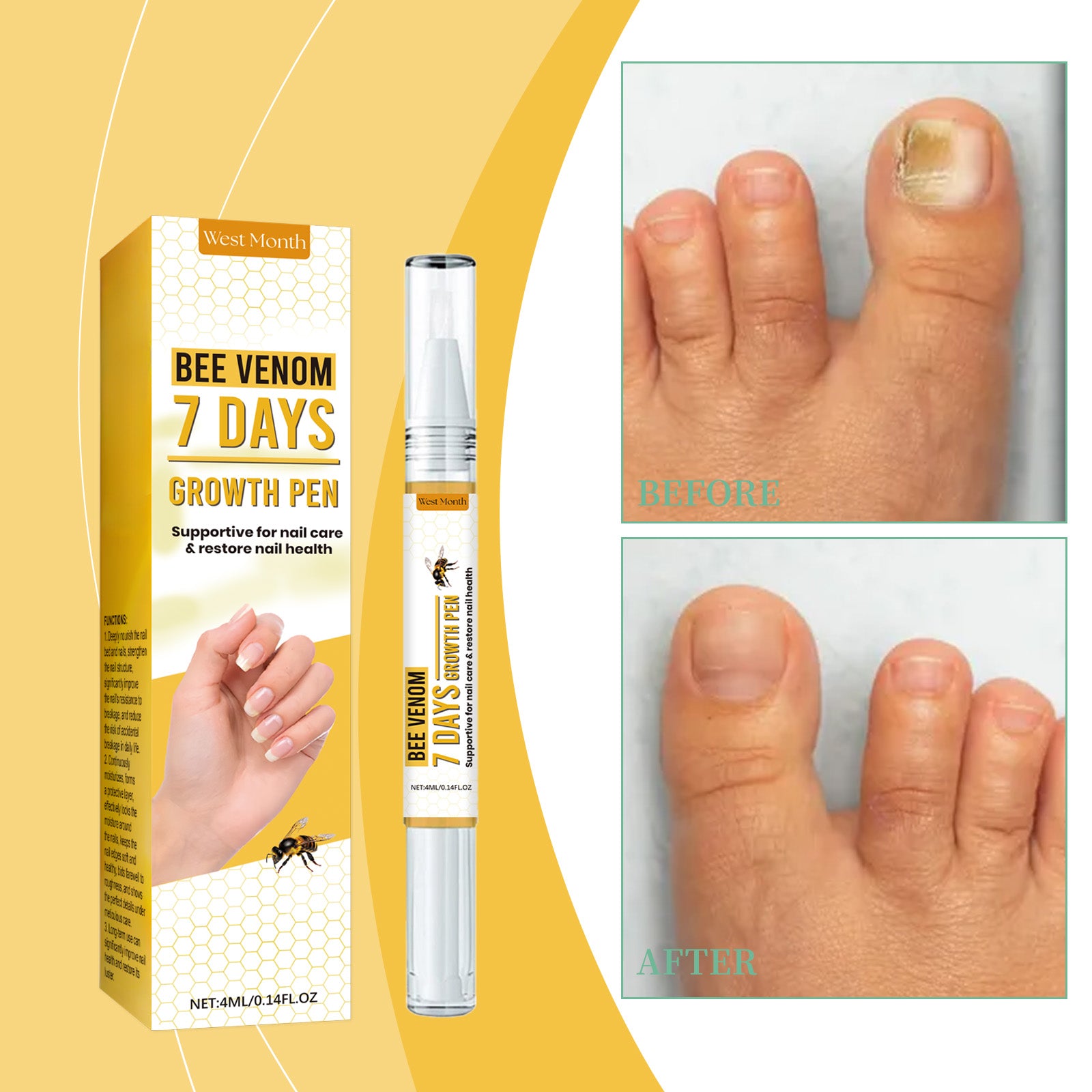 West&Month Nail Repair Solution, Hand And Foot Nail Cleaning Care Gentle Moisturizing And Moisturizing Nail Repair Solution - 5 - CJ