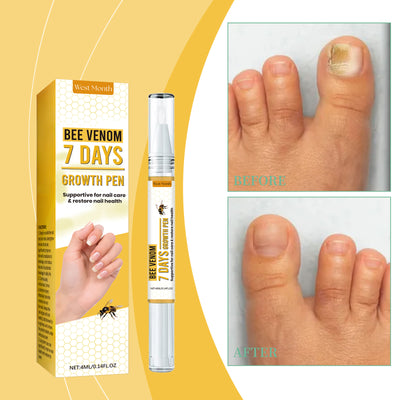 West&Month Nail Repair Solution, Hand And Foot Nail Cleaning Care Gentle Moisturizing And Moisturizing Nail Repair Solution - 5 - CJ