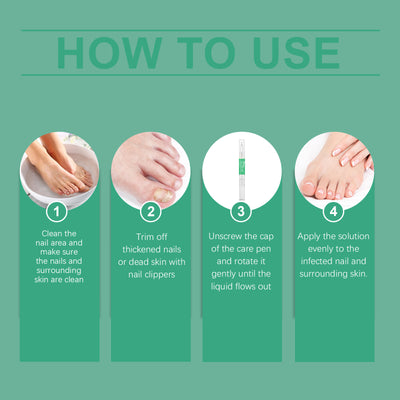 South Moon Nail Repair Pen Moisturizes Gently Repair Hands And Feet Gray Nails Soft Nails Thick Nails Foot Care - 5 - CJ