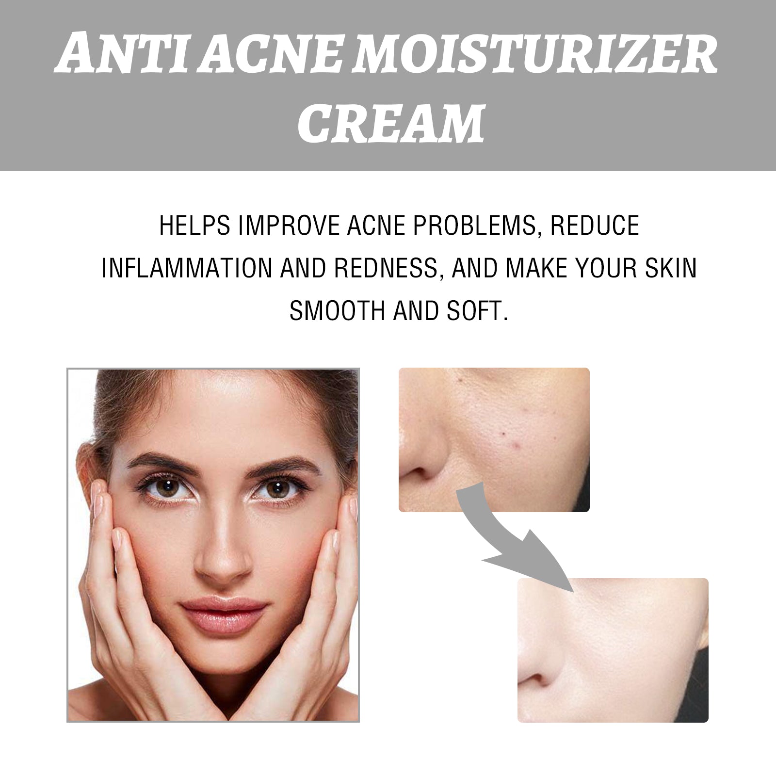 Eelhoe Hydrating Cream Hydrating And Lightening Facial Acne Repair Redness Hydrating And Brightening Moisturizing Cream - 5 - CJ