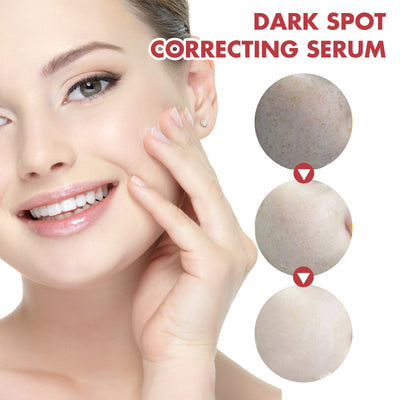 Hoygi Black Spot Repair Essence Lighten Skin Black Spot And Age Spot Moisturizing&Brightening Repair Essence - 5 - CJ