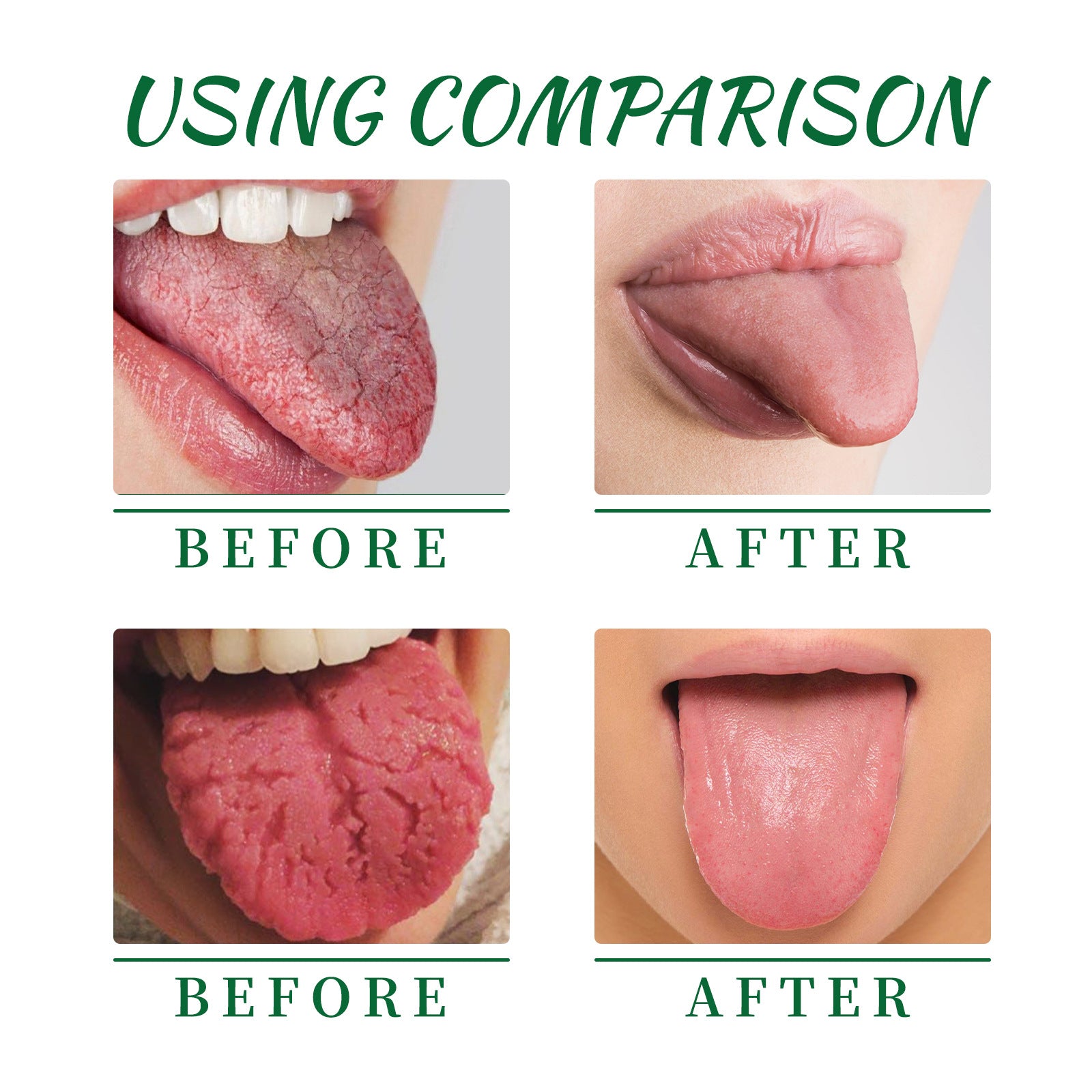 EELHOE Tongue Repair Spray Repair White Tongue Relief Dry Swollen Tongue Oral Care Spray - 5 - CJ