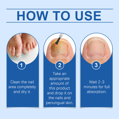 South Moon Nail Care Essence, Clean Fingernails Odor Soft Nail Groove Moisturizing Nail Care Solution - 5 - CJ