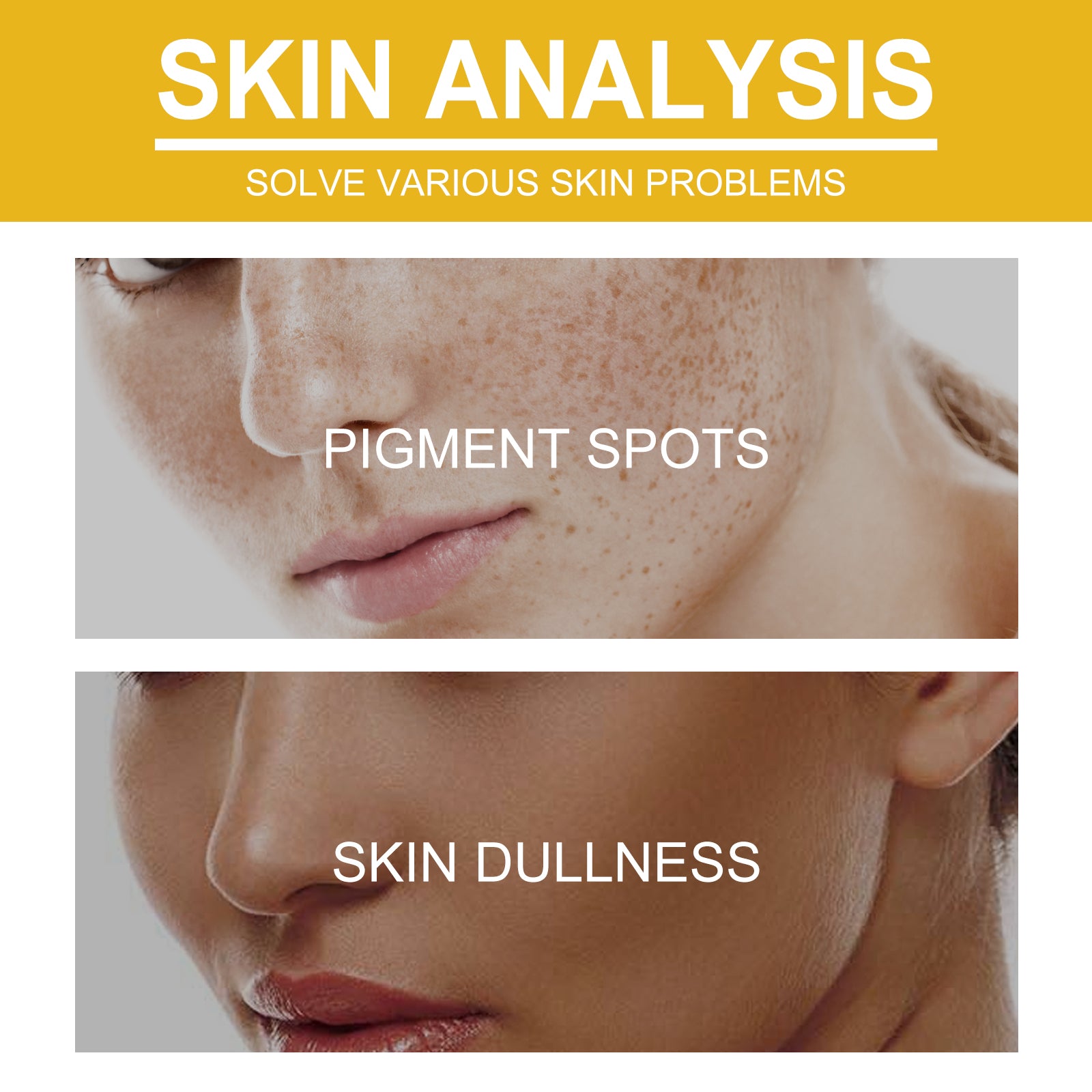 Wiyun V7 Whitening Cream Reduces Wrinkles And Fine Lines On The Face, Moisturizes And Brightens Skin, Anti - Aging And Replenishing Cream - 5 - CJ