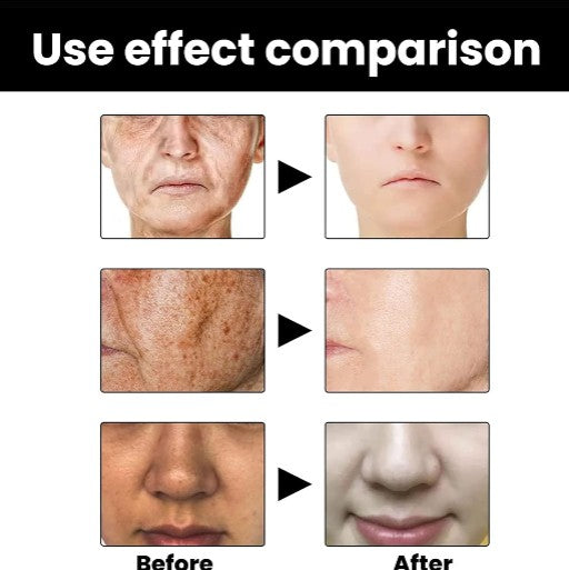 Eelhoe - Melanin Correcting Serum