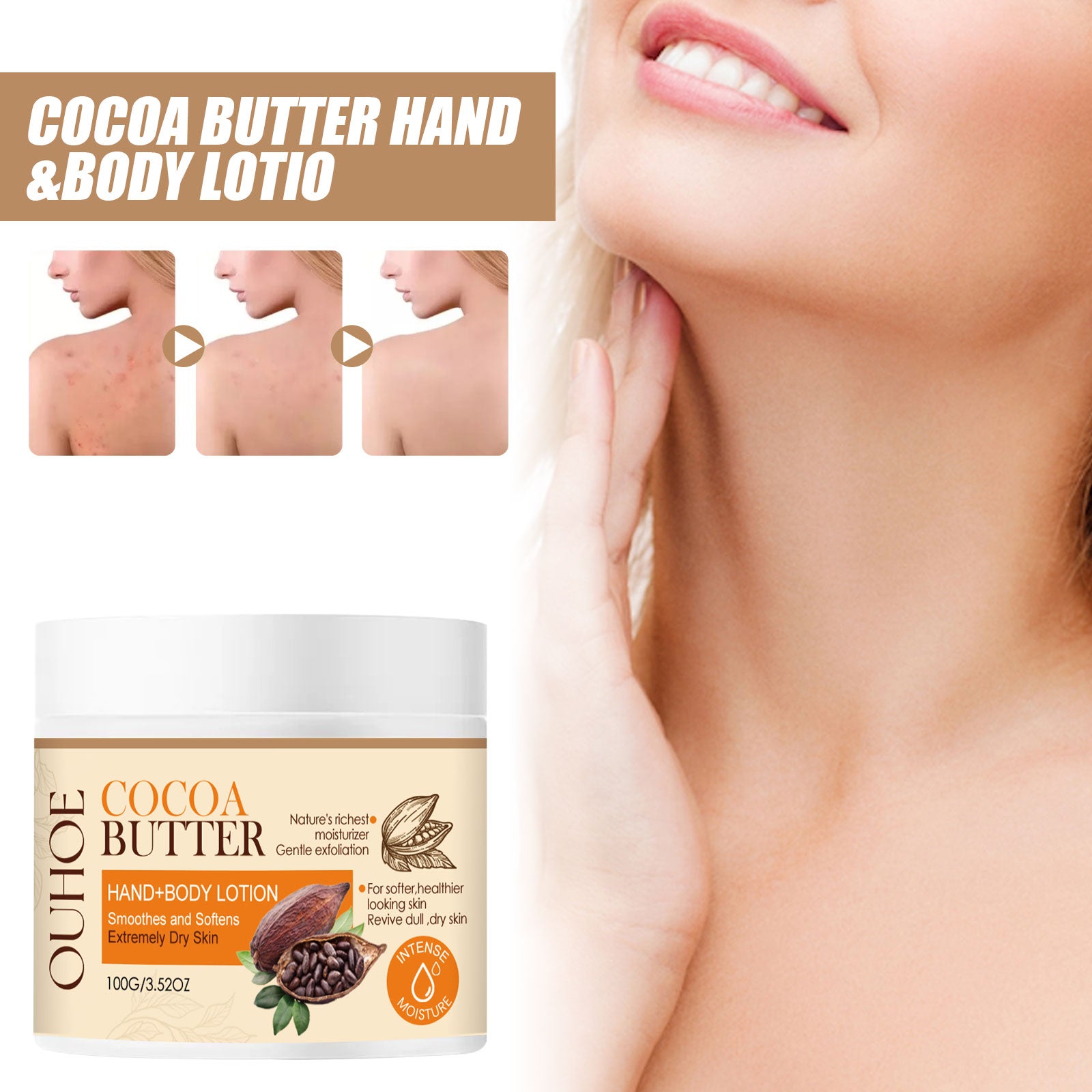 OUHOE  Cacao Body Lotion, Lightening Acne Mark Dark Hydrating Whitening Body Lotion - 5 - CJ