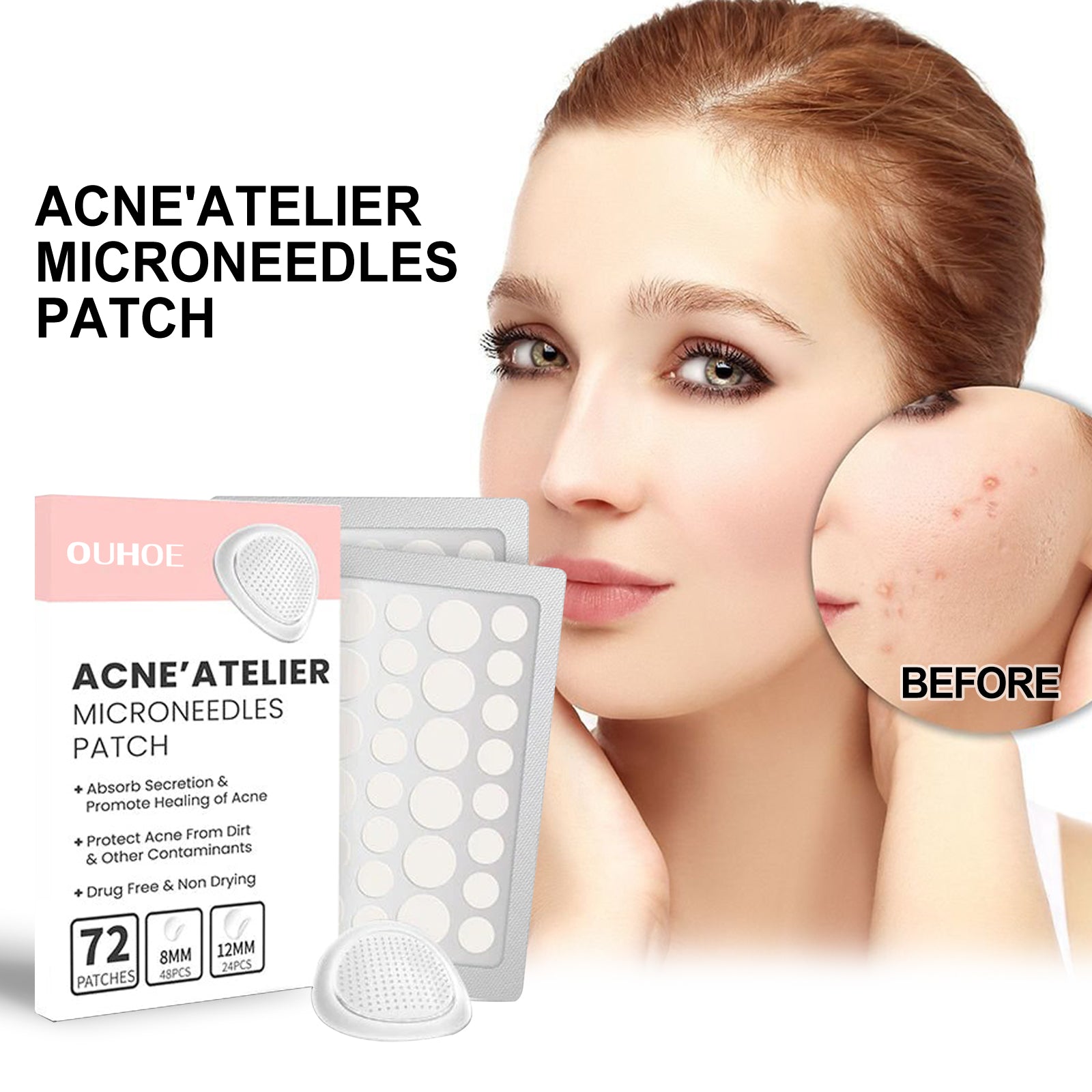 OUHOE Acne Patch Repair Acne Acne Redness Pore Cleansing & Moisturizing Patch - 5 - CJ