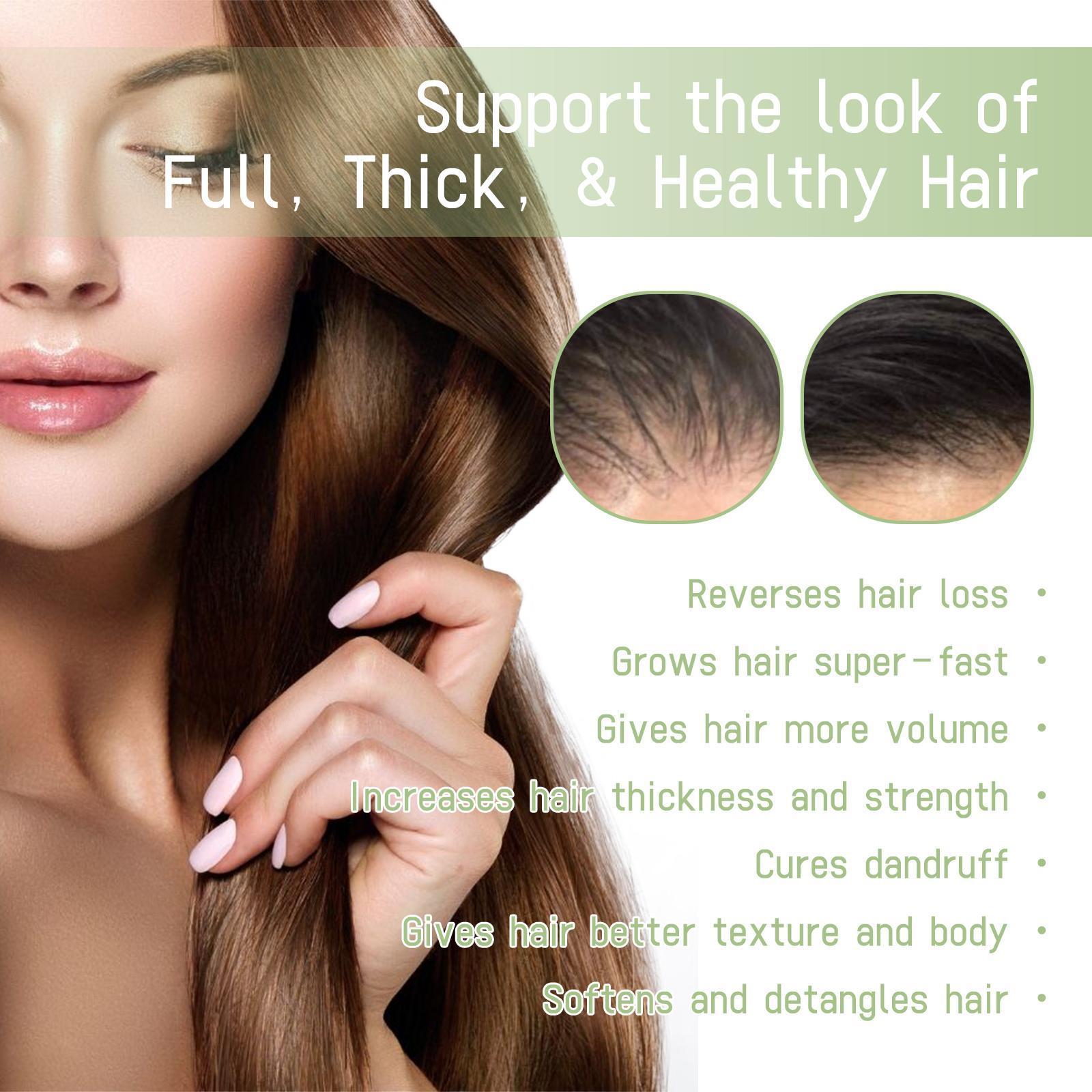 Ohoy Herbal Hair Oil Gently Nourishes The Scalp, Strengthens Hair, Cleanses The Scalp And Softens Hair - 5 - CJ