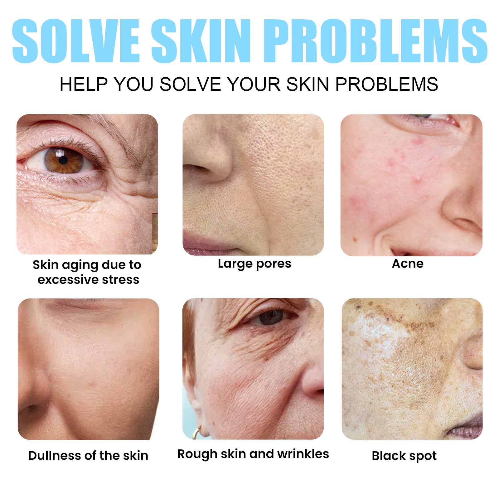 EELHOE Sea Grape Facial Essence Lifts And Tightens Wrinkles, Shrinks Pores, Repairs And Tender Skin - 5 - CJ