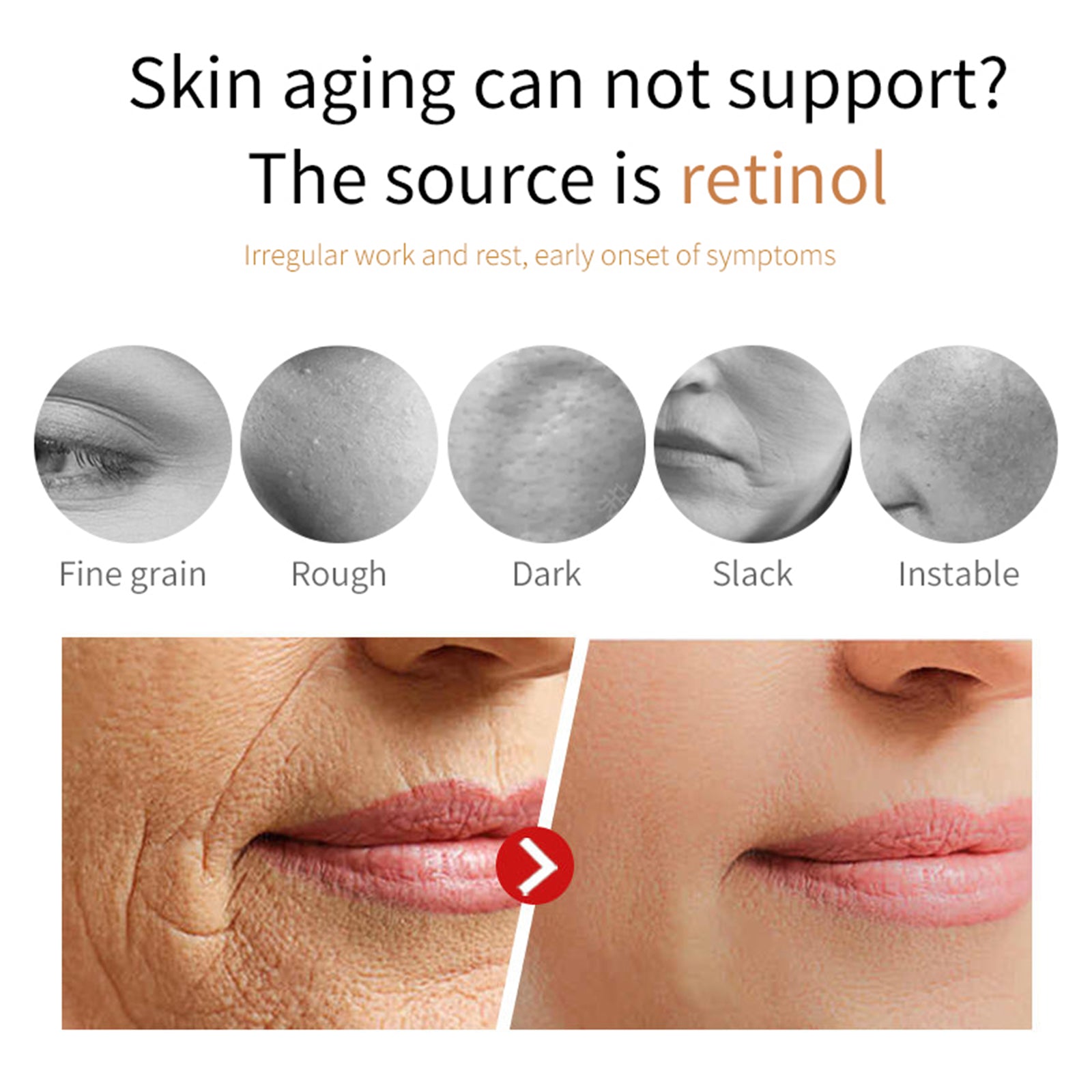 Hoygi Retinol Face Cream, Firming Smooth Skin To Fade Out Fine Lines Dry Tyra Facial Contour Lines - 5 - CJ