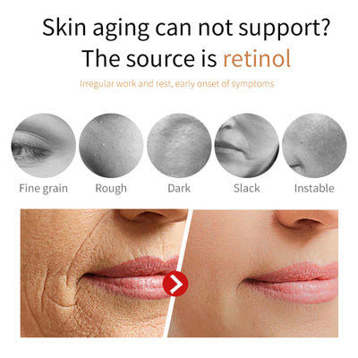 Hoygi Retinol Face Cream, Firming Smooth Skin To Fade Out Fine Lines Dry Tyra Facial Contour Lines - 5 - CJ