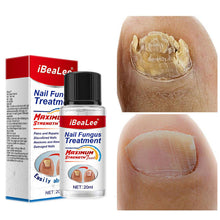 Thickening Of Special Bacteriostatic Liquid For Onychomycosis - 0 - CJ - 20ML - CJJY158798101AZ