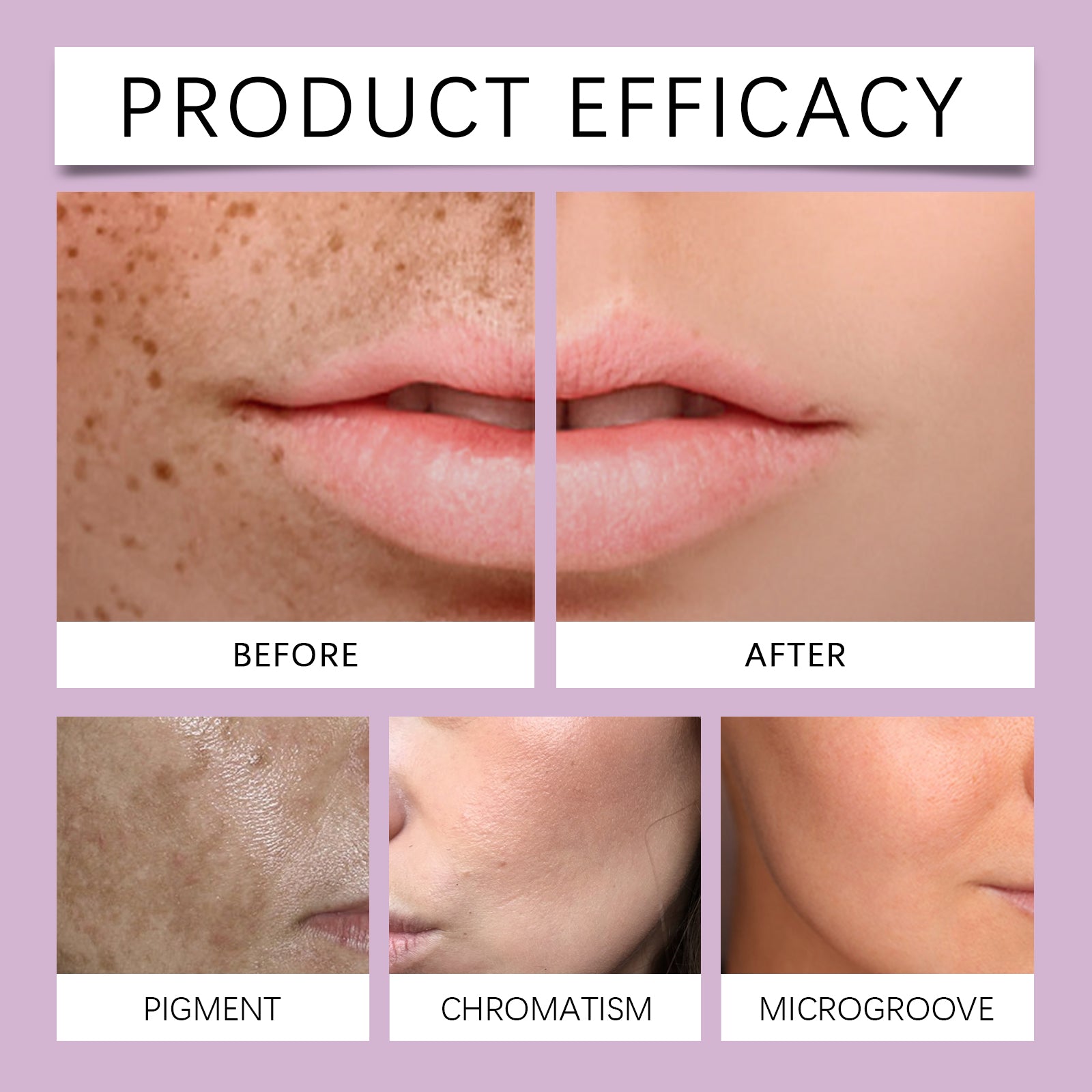 Hoygi Tone Balancing Essence, Desalination Moisturizing Facial Spots Moist Shine Bright Skin Essence - 5 - CJ