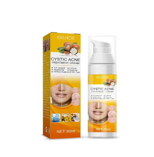 Eelhoe - Cystic Acne Cream - 5 - CJ