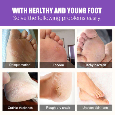 EELHOE Ginger Foot Mask (Bag) Foot Moisturizing, Nourishing, Rejuvenating, Exfoliating, Removing Dead Skin, Dry And Cracked Skin Care Foot Mask - 5 - CJ
