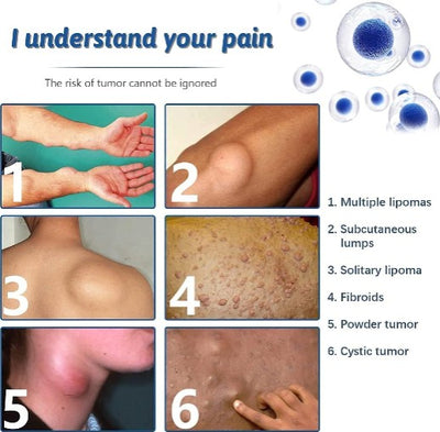 South Moon - Lipoma Removal Spray - 5 - CJ