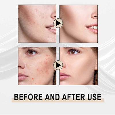 Jaysuing Lactobionic Acid Liquid Exfoliating Blackheads Shrinking Pores Cleansing Moisturizing Skin - 5 - CJ