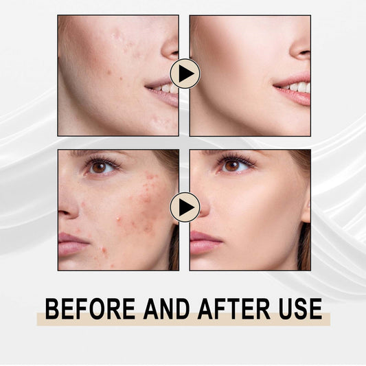 Jaysuing Lactobionic Acid Liquid Exfoliating Blackheads Shrinking Pores Cleansing Moisturizing Skin - 5 - CJ