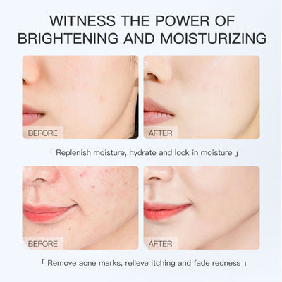 Gongpei Brightening Extract Sheet Mask 25ml Per Sheet - 4 - CJ