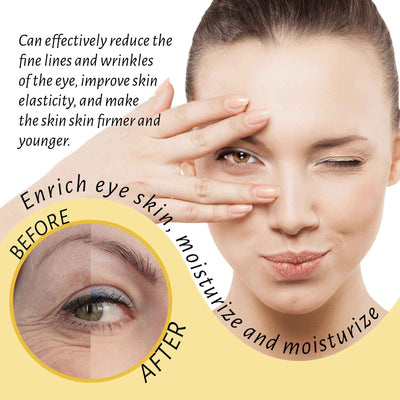 Hoygi Eye Ball Essence Oil Moisturizes And Moisturizes Eye Skin, Lightening Fine Lines And Softening Eye Area Essence Oil - 5 - CJ