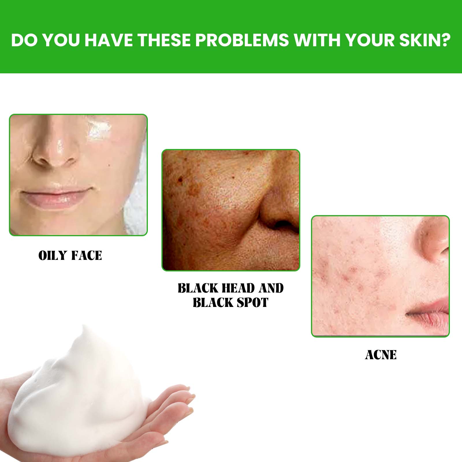 EELHOE Anti Acne Facial Wash, Deep Clean Oil Dirt Blackhead Acne Shrink Pores Refreshing And Comfortable - 5 - CJ