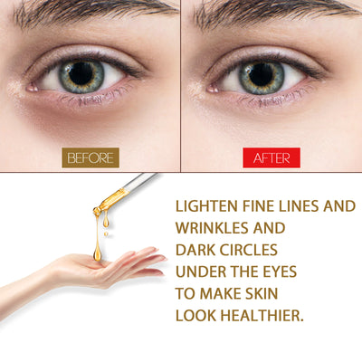 EELHOE Anti - Aging Eye Serum, Eye Bags, Pores, Eyes, Fine Lines And Dark Circles Care Essence - 5 - CJ