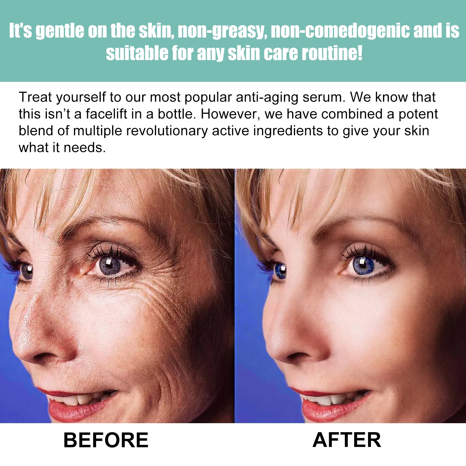 OUHOE This Facial Essence Is A Gentle, Moisturizing, Hydrating And Softening Daily Skin Care Essence For The Face - 5 - CJ