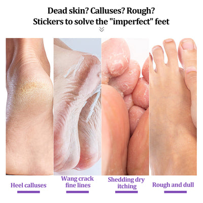 EELHOE Ginger Foot Mask (Bag) Foot Moisturizing, Nourishing, Rejuvenating, Exfoliating, Removing Dead Skin, Dry And Cracked Skin Care Foot Mask - 5 - CJ