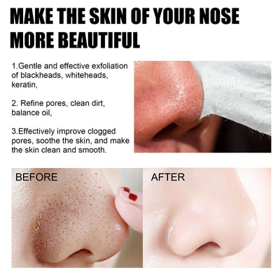 EELHOE Blackhead Removal Nasal Mask Deep Pore Cleansing Blackheads & Acne Rip - Off Nasal Mask - 5 - CJ