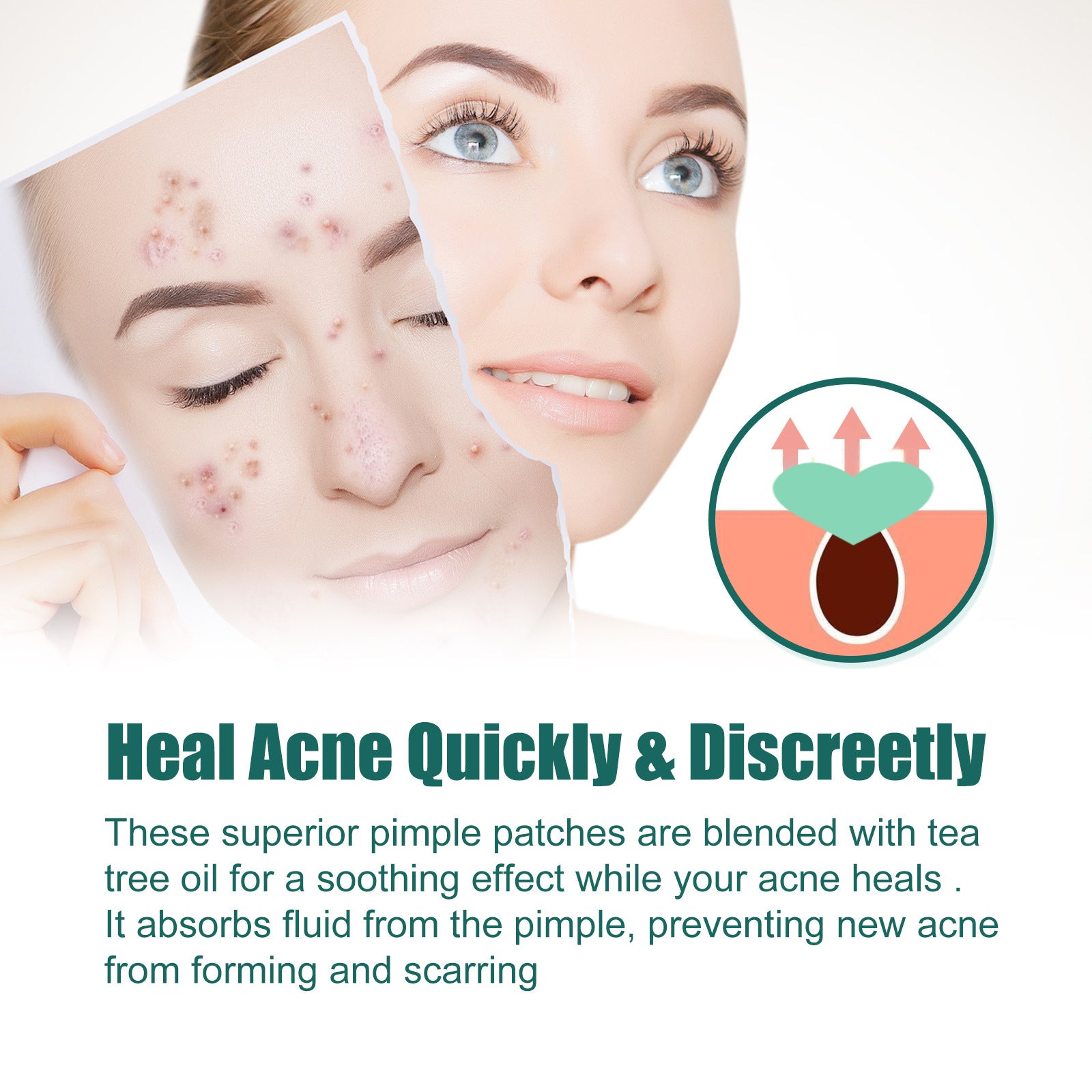 EELHOE Love Acne Patch Gentle Cleansing Acne Patch Fades Facial Acne Marks And Spots Facial Cleansing Care - 5 - CJ