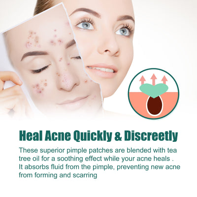 EELHOE Love Acne Patch Gentle Cleansing Acne Patch Fades Facial Acne Marks And Spots Facial Cleansing Care - 5 - CJ