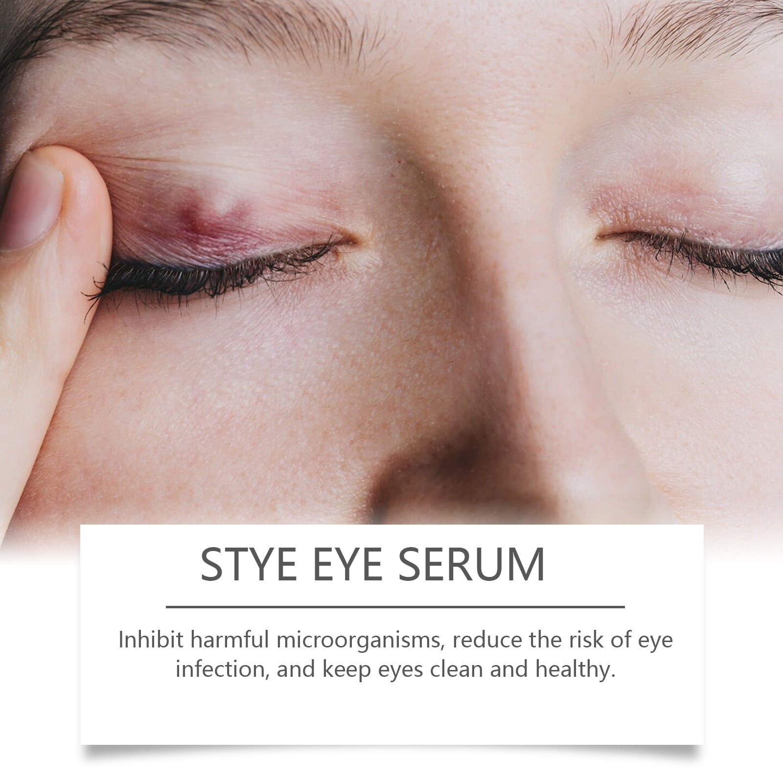 OUHOE Eye Care Drops Gently Nourish And Moisturize The Skin Around The Eyes. Portable Daily Eye Care Drops - 5 - CJ