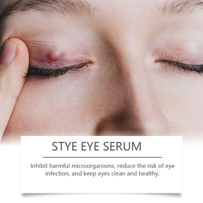 OUHOE Eye Care Drops Gently Nourish And Moisturize The Skin Around The Eyes. Portable Daily Eye Care Drops - 5 - CJ
