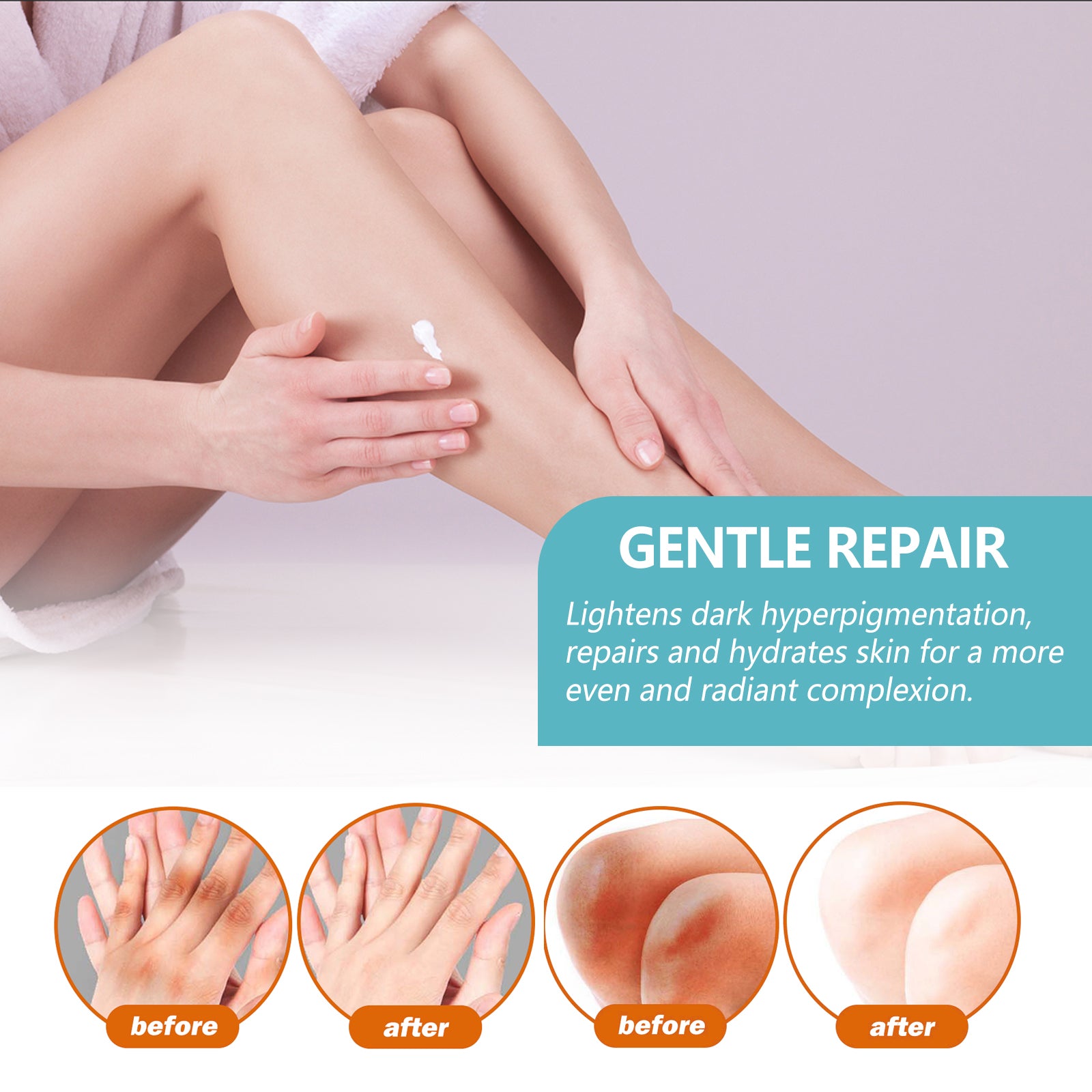 EELHOE Black Echinacea Repair Cream Repair Underarms Arms Knees Joints Dark Moisturizing Whitening Body Cream - 5 - CJ