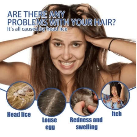 Scabies - Lice Spray - 5 - CJ