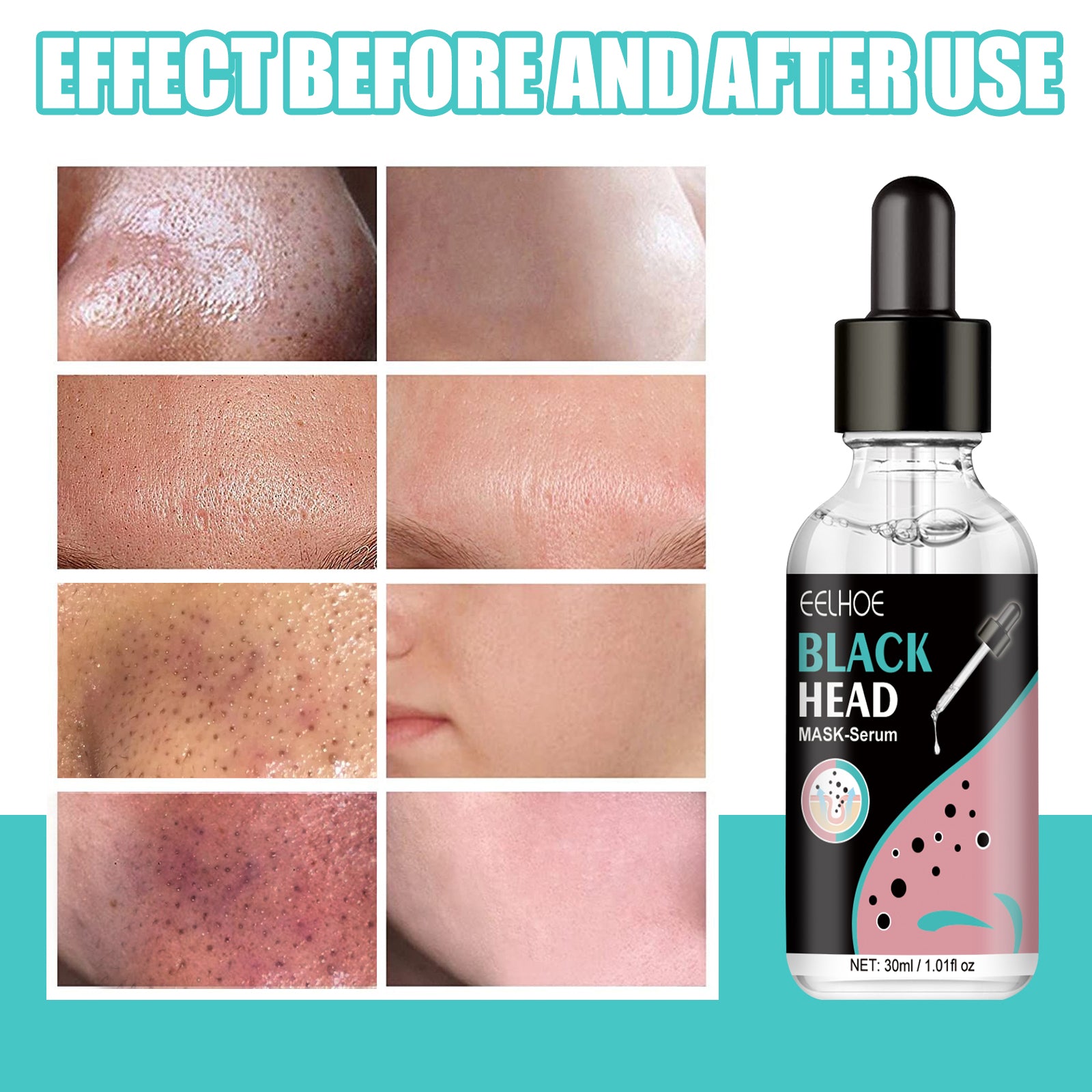 EELHOE Blackhead Nose Mask Moisturizes And Smoothes The Skin, Removes Blackheads From Acne And Deeply Cleans Pores And Dirt - 5 - CJ