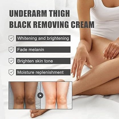 Dark Spot Remover Cream - 5 - CJ