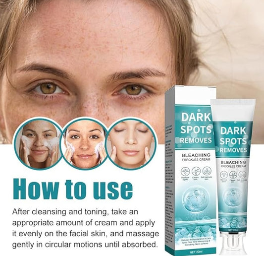 Eelhoe - Dark Spots Removes Cream - 5 - CJ