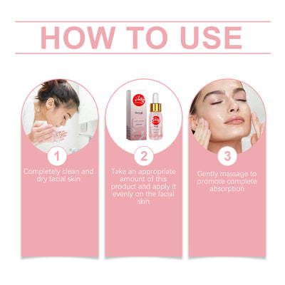 Hoygi Nicotinamide Anti - Acne Serum Mild Anti - Acne Serum Improve Acne Moisturizing Repair Serum - 5 - CJ
