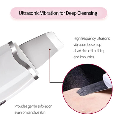 3 - in - 1 Ultrasonic Facial Spatula For Deep Cleansing, Electric Ultrasonic Skin Scrubber - 5 - CJ