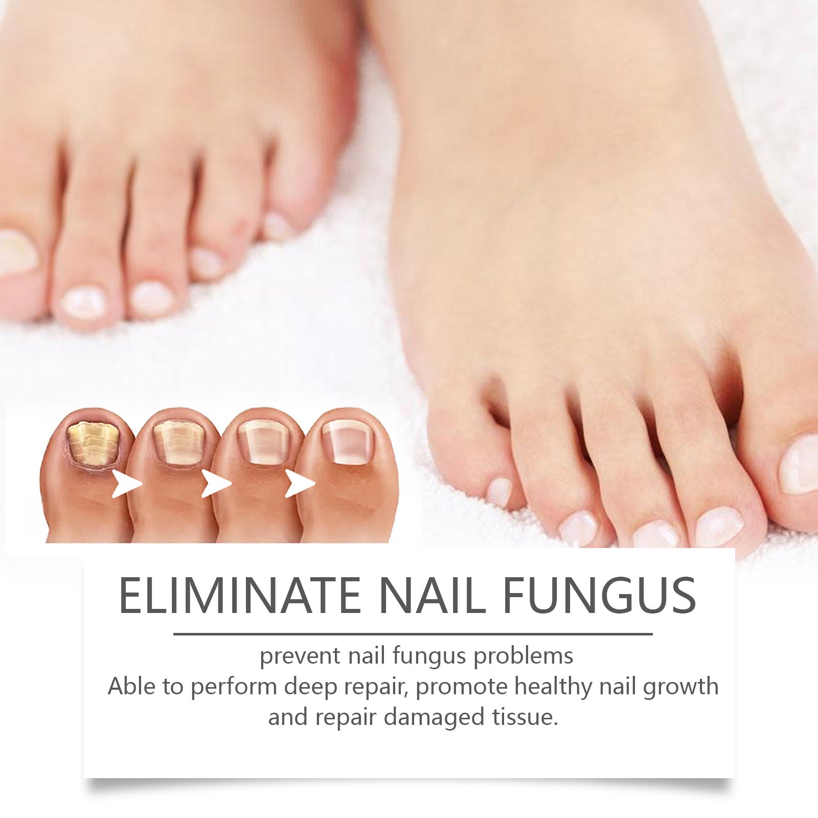 South Moon Nail Repair Pen Moisturizes Gently Repair Hands And Feet Gray Nails Soft Nails Thick Nails Foot Care - 5 - CJ
