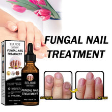 EELHOE Nail Repair Solution Thickening And Shining Nail Removal Dead Skin Repairing And Moisturizing Nail Nutritional Care Liquid - 5 - CJ
