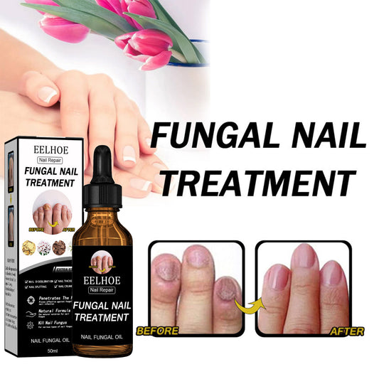 EELHOE Nail Repair Solution Thickening And Shining Nail Removal Dead Skin Repairing And Moisturizing Nail Nutritional Care Liquid - 5 - CJ