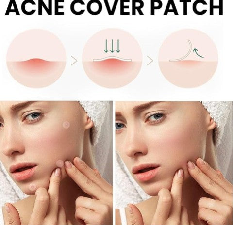 Acne Cover Patch - 5 - CJ