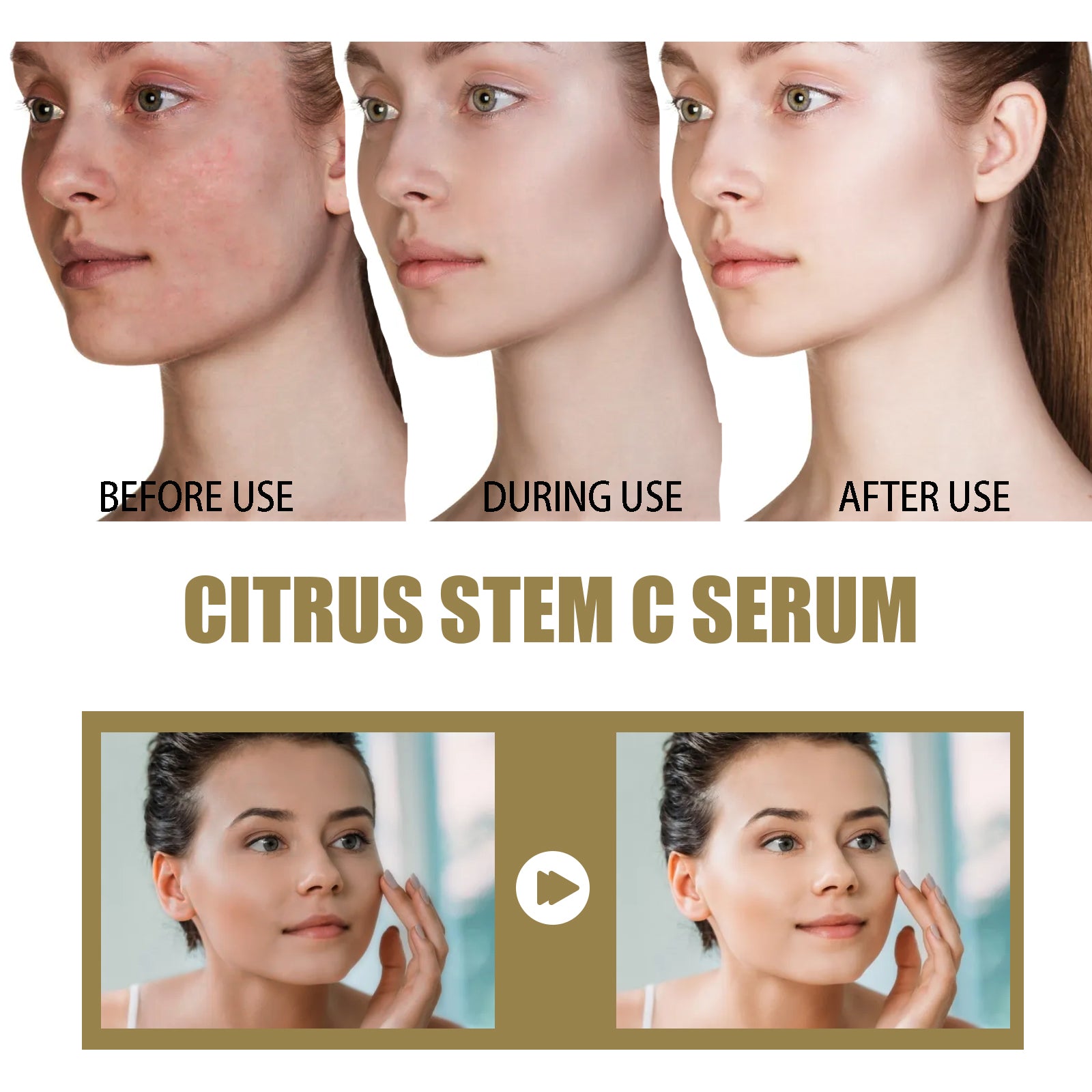Hoygi Citrus Stem C Serum, Reduce Wrinkles Improve Skin Elasticity Firming And Lifting Anti - Aging Serum - 5 - CJ