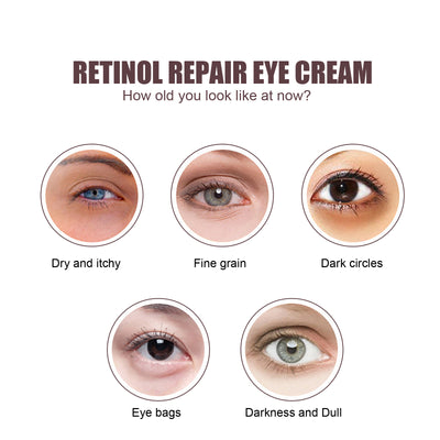 Hoygi Retinol Repair Eye Cream, Reduce Wrinkles Fine Lines Bags Dark Circles Brightening Skin Anti - Wrinkle Repair Eye Cream - 5 - CJ