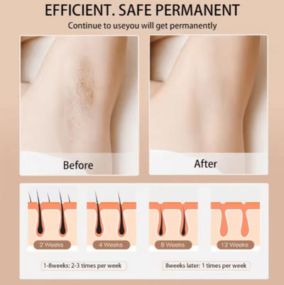 Babyverse - Digital IPL Hair Removal Device - 5 - CJ