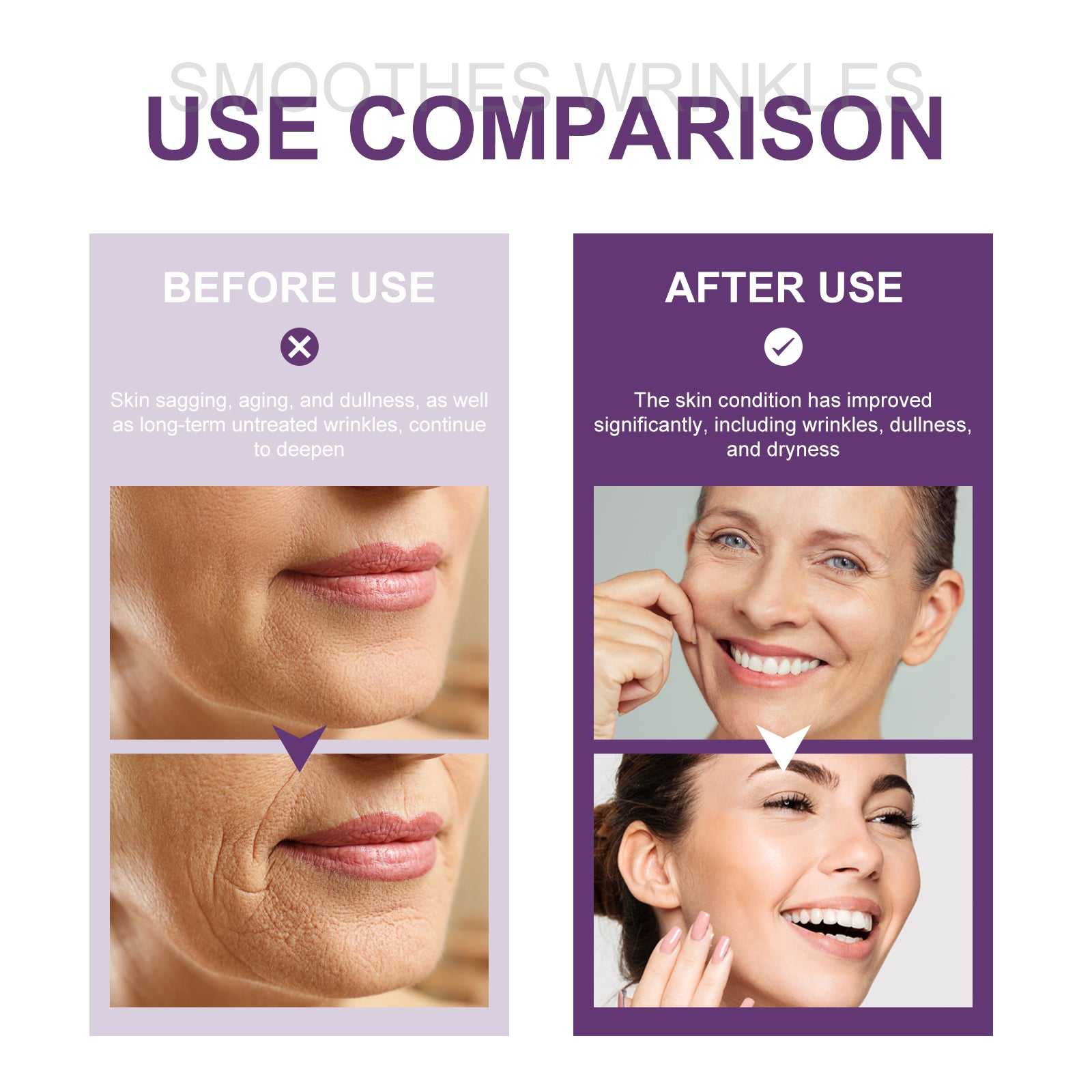 Eelhoe Retinol Face Essence Anti - Wrinkle Whitening Moisturizing Brightening Skin Care Face Essential Oil - 5 - CJ